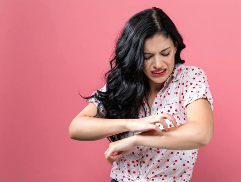 Young woman scratching her itchy arm (Stay Bite-Free: Colors To Avoid Wearing That Attract Mosquitoes)